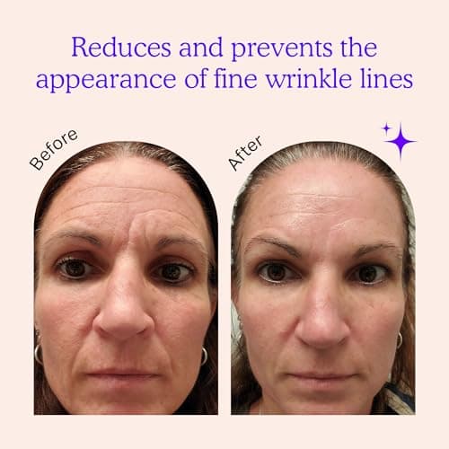 BLUMBODY Face, Forehead Wrinkle Patches - Anti Wrinkle Facial Patches to Smooth Eye, Mouth, Forehead Wrinkles - Non-Silicone Face Tape for Fine Wrinkles between Eyes, Face - Patches (30 day supply)