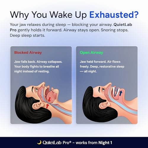 QuietLab Pro Anti-Snoring Mouthpiece - Adjustable Snoring Mouth Guard, Orthodontist Designed, No Boiling Required - BPA-Free Medical Grade - Designed for Nighttime Snoring Control